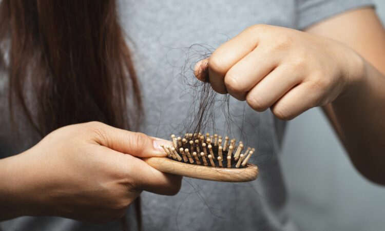 Understanding Menopause-Related Hair Loss: A Comprehensive Guide